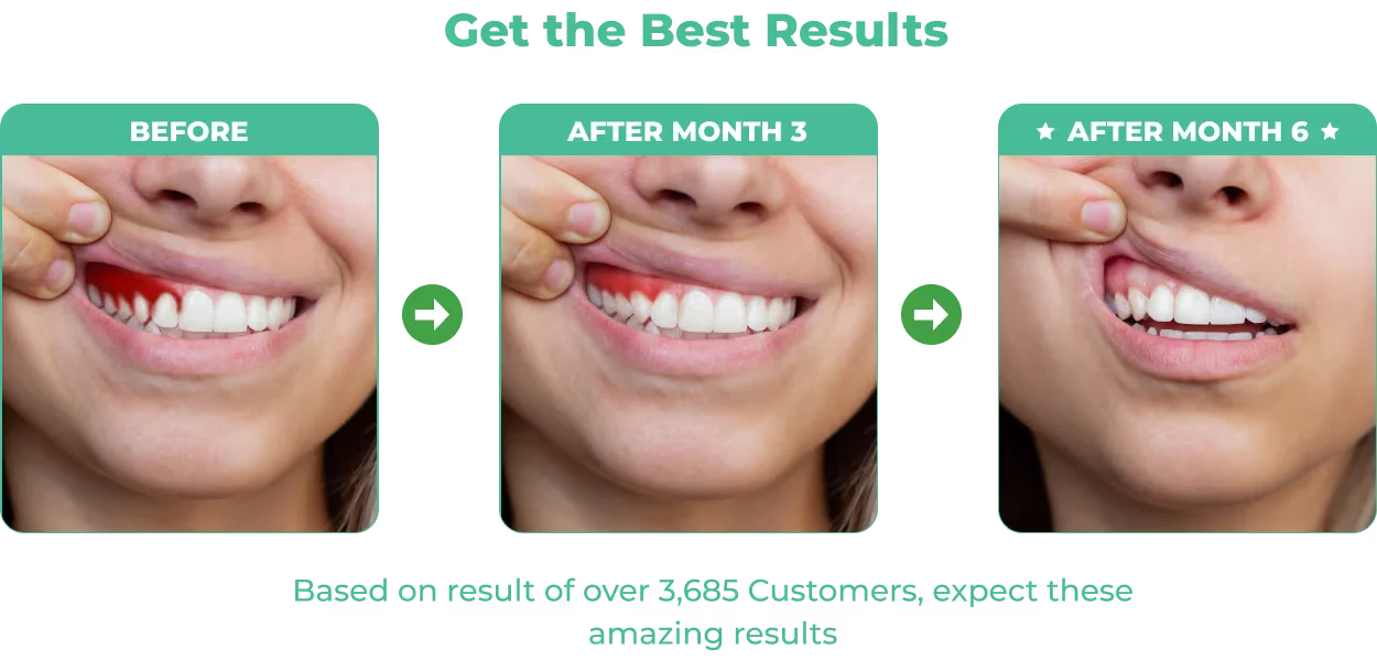 DentalPrime Natural Oral Health Supplement