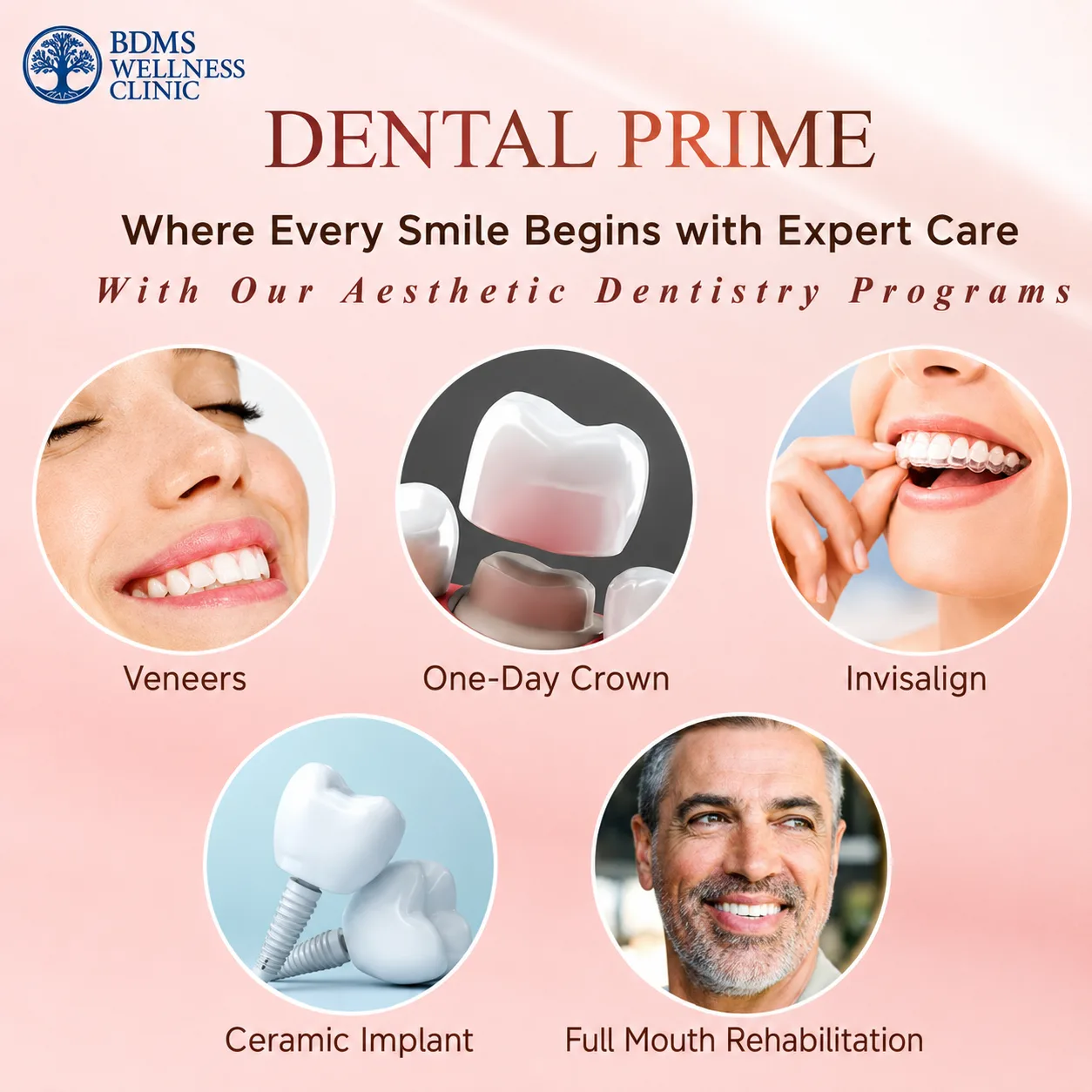 How Does DentalPrime Work